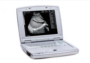 Buy cheap Ultrasound Scan Machine Portable Ultrasound Scanner with 10.4 Inch LED Monitor product