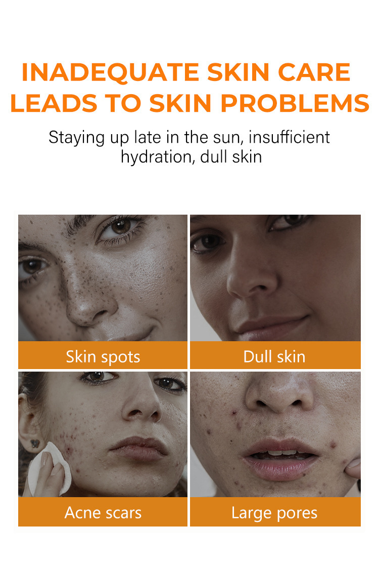 Private Label Face Toner Moisturizing Spray Deep Face Hydrating Quickly Absorb VC Whitening Skin Moisturizing Face Spray