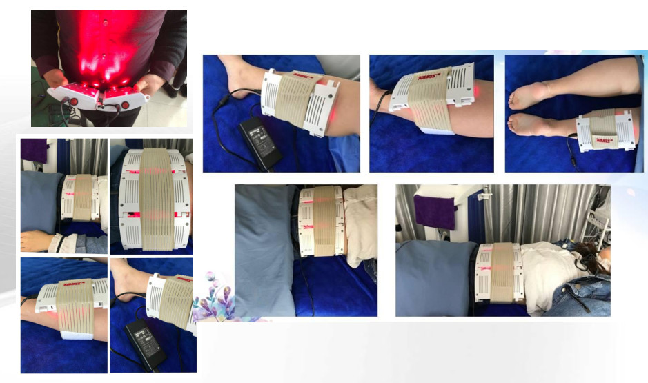 780nm 980nm 5D Lipo Laser Slimming Machine Fat Reducing Diode 808 Machine