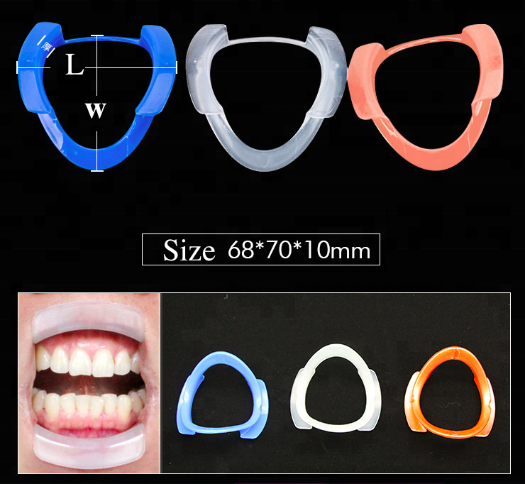 Plastic C Shape Disposable Dental Cheek Retractor Mouth Opener The Game-Changer for Medium/Large Orthodontic Procedures