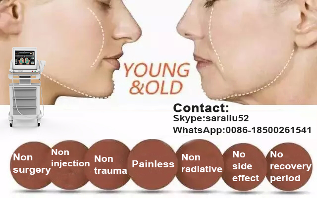 Distributors wanted hifu wrinkle removal/hifu face lift/portable hifu machine with 15 inch big screen