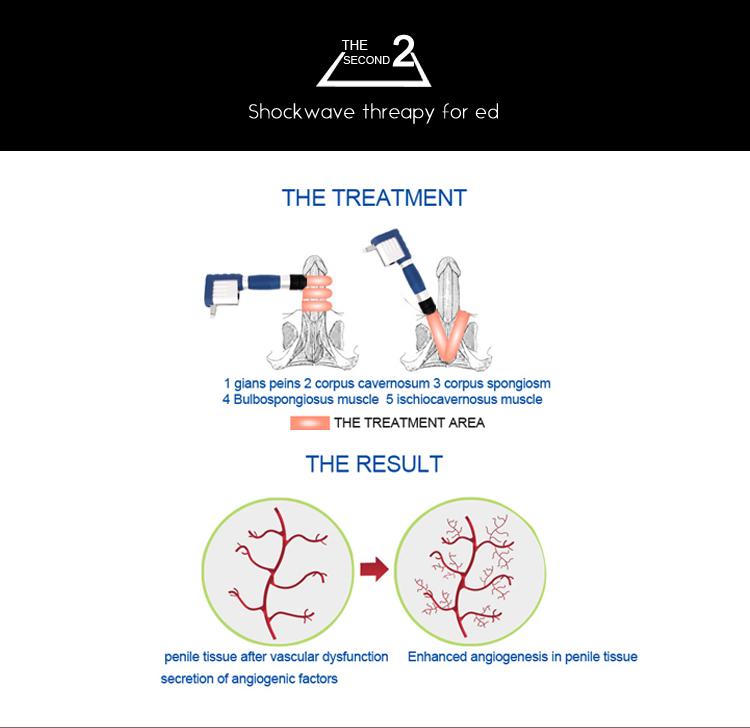 Build In Silence Powered Air Compressor Shockwave Therapy For Ed Treatment