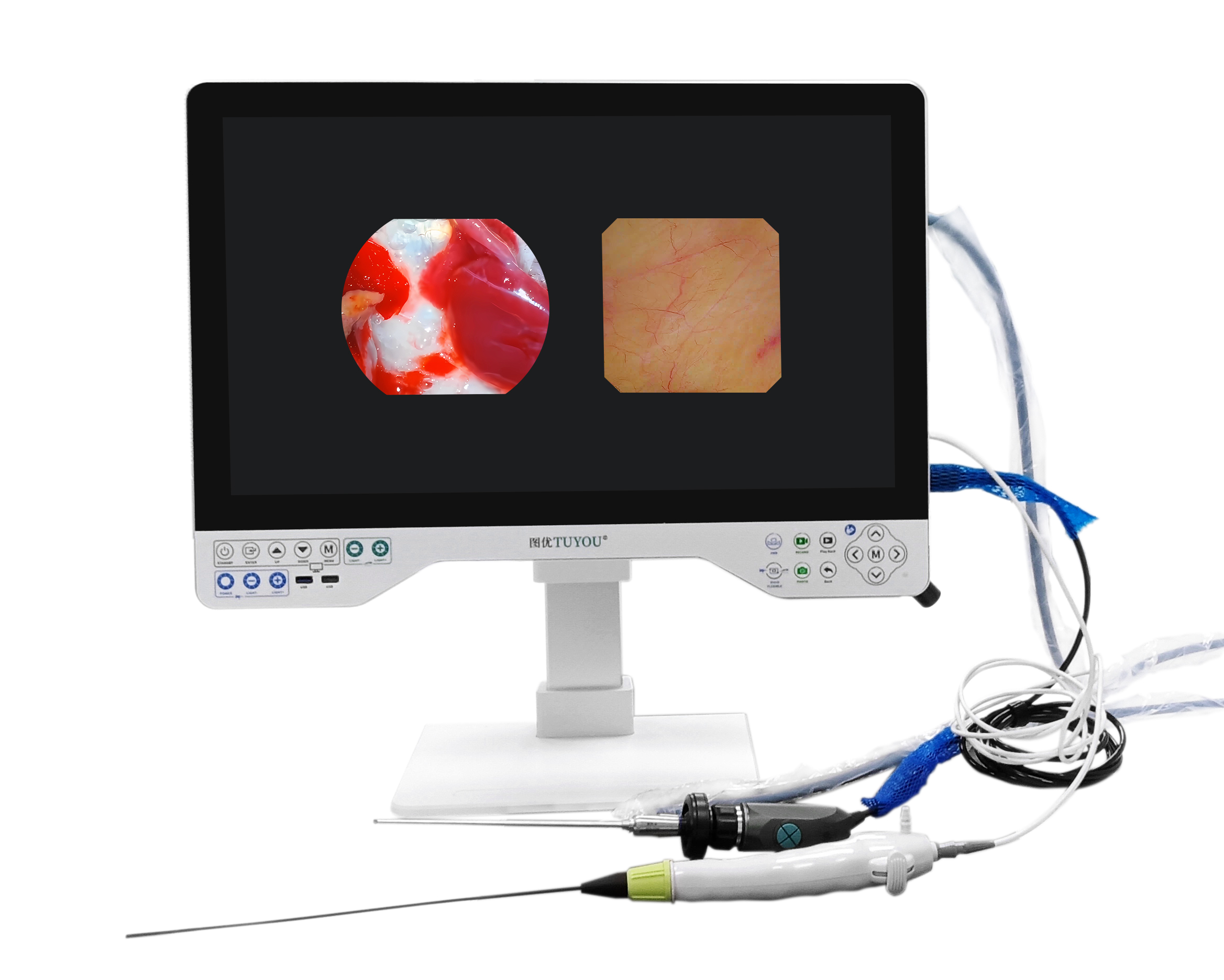 TUYOU 15.6'' UHD All In One Rigid Multi Flexible Endoscopy Camera System For Endoscopy Of Uterus