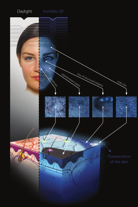 OBSERV 520 Lastest Skin Analyzer Best Skin Tester Professional Skin Scanner