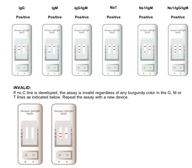 For Laboratory Or Hospital High Accuracy DENGUE IgM/IgG Whole Blood Serum Elisa Test Kit