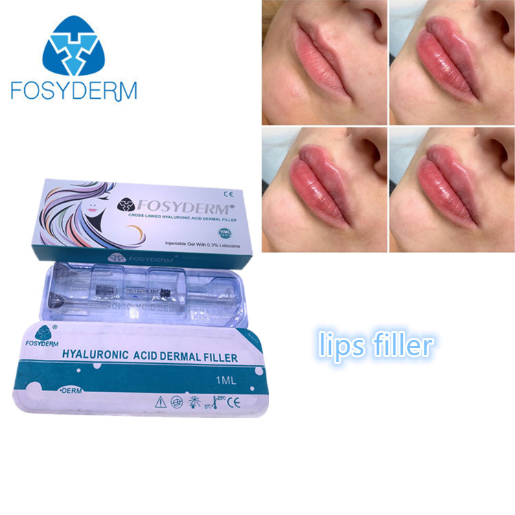 Fosyderm Gel Hyaluronic Acid
