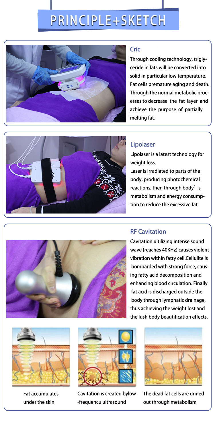 4 in 1 weight loss cavitation rf cryolipolysis lipo laser/criolipolisis fat freezing machine/cryolipolysis slimming mach