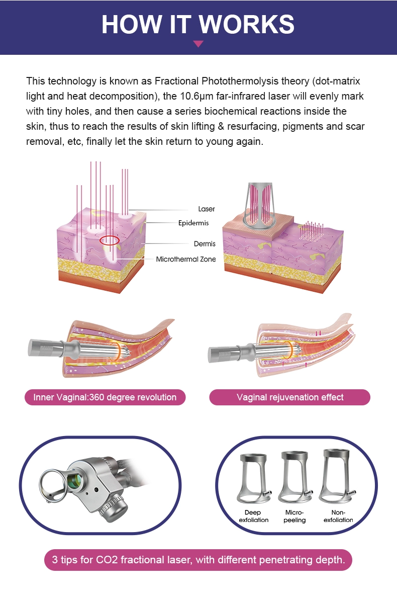 Gynecology CO2 Fractional Laser Machine For Vaginal Tightening