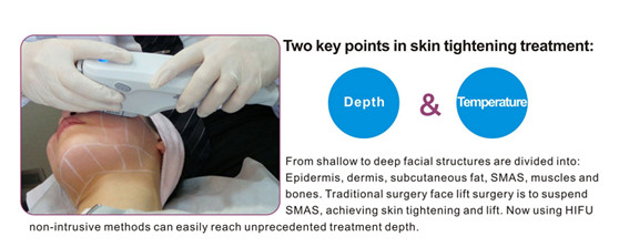 0.1 - 2.5J Skin Lifting Skin rejuvenation Machine HIFU Machine With Changeble Spot Size