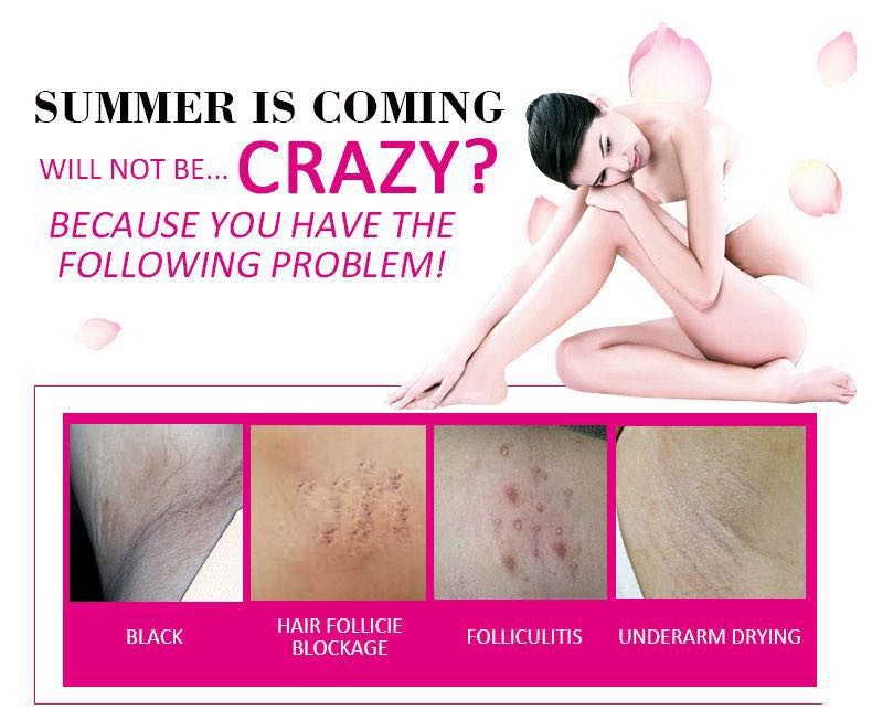 beauty armpit whitening cream for dark underarms
