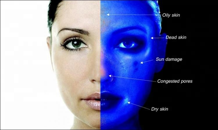 Cosmetics Using 3D Wrinkle Analysis Machine RGB + UV + PL 3 Spectrums