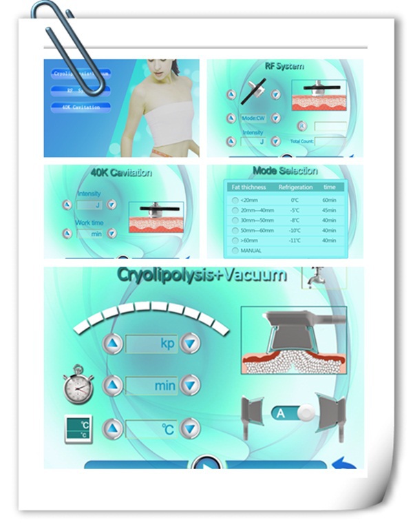 Nubway 5 Cryolipolysis cooling handles tech fat freezing machine for whole body slimming