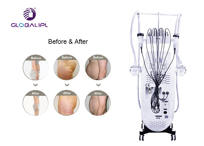 Cryotherapy Fat Reduction Equipment / Body Slimming Machine With Ce Approval