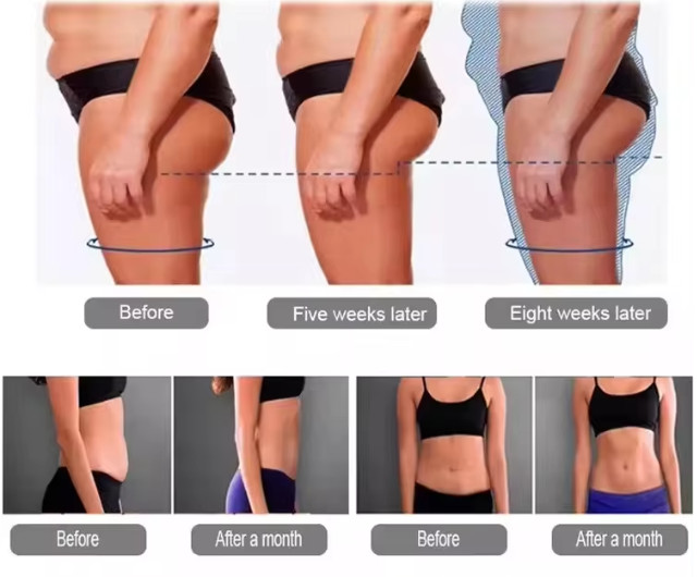 Professional Zero Contouring Sculpting Ems Muscle Stimulate Body Slimming Machine