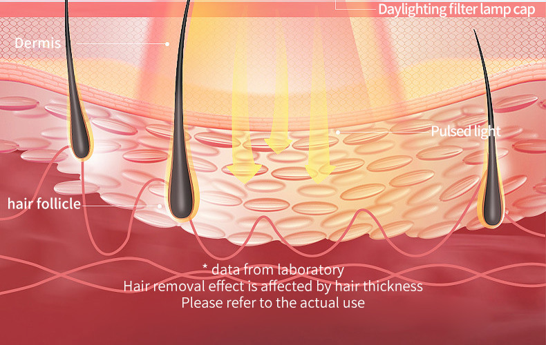 Ice Cool Ipl Laser Hair Epilator Removal Machine Permanent Painless Hair Remover Device