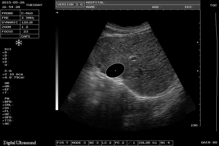 10.4" HD USG Scan Machine Color Doppler Ultrasound Scanner SVGA Output
