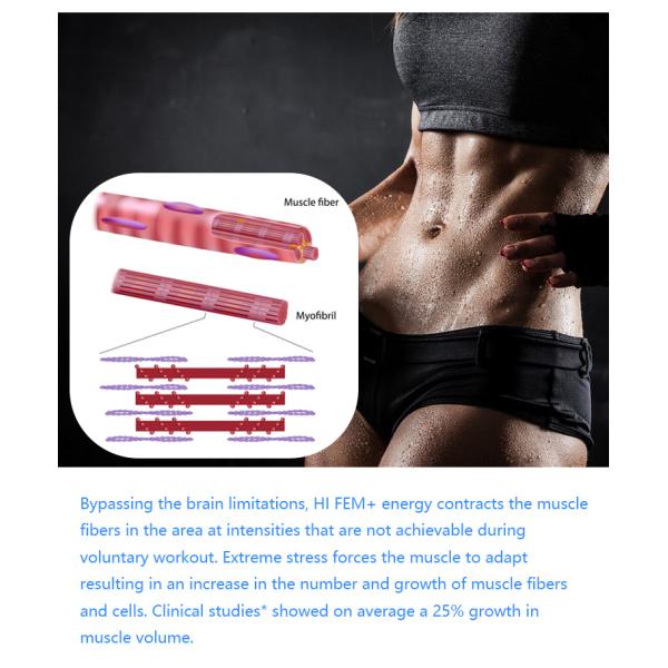 Top 5 selling Portable Ems Body EMShape Em Slim Neo Muscle Stimulator Machine / Ems Neo Rf Slimming Machine