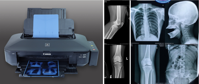 High quality film digital x ray pet medical films  x ray film