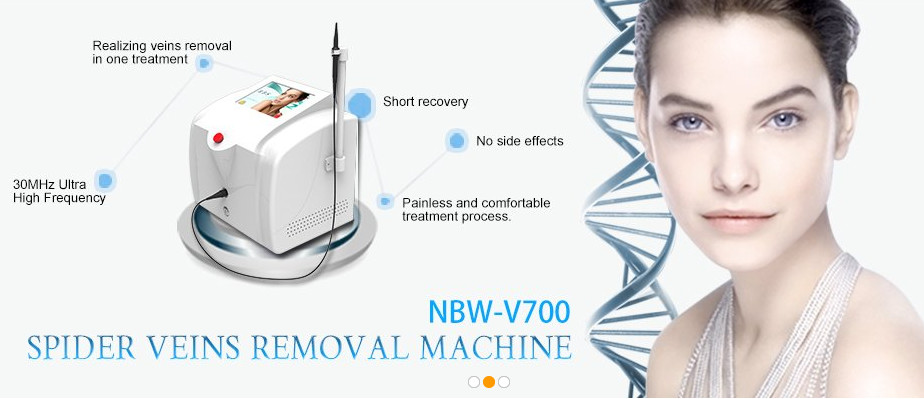 Spider vein laser removal Laser varicose vein removal treatment