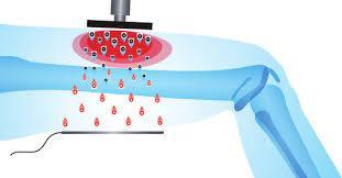 Double 80mm Handle Tecar Therapy Diathermy Machine RF Tecar Microwave Diathermy Equipment For Muscle Relax