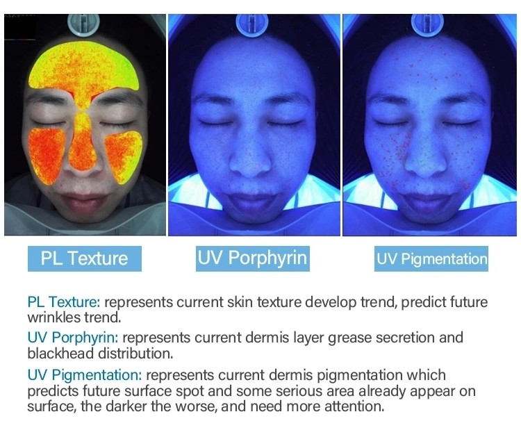 M9 RGB+UV+PL Light Skin Scope Analyzer 20 Mega For Beauty Spa Clinic Salon