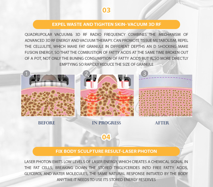 7 In 1 Vacuum Cavitation Machine Body Slimming RF Laser Beauty Instrument