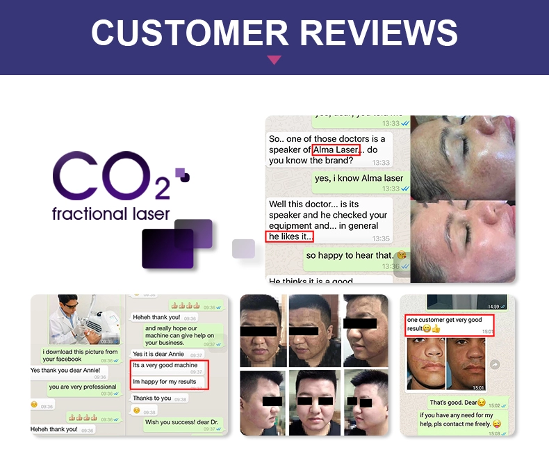 Gynecology CO2 Fractional Laser Machine For Vaginal Tightening