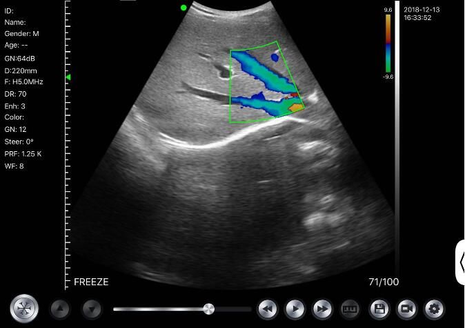 Mini Handheld Ultrasound Scanner Portable Color Doppler With Multi-Frequency 2-10MHz 128 Elements 64 Channels 5