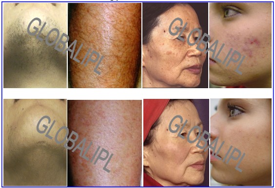 B&A.jpg