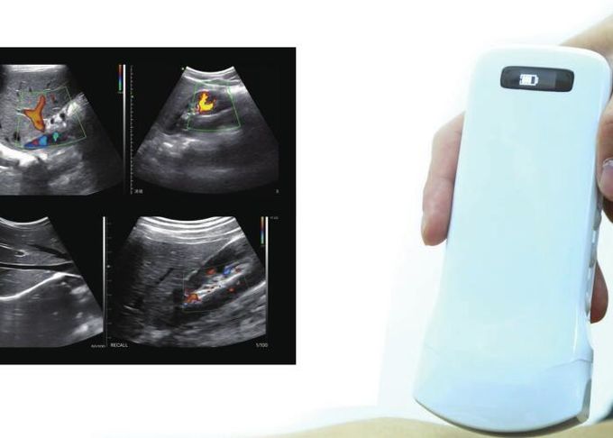 Mini Handheld Ultrasound Scanner Portable Color Doppler With Multi-Frequency 2-10MHz 128 Elements 64 Channels 4