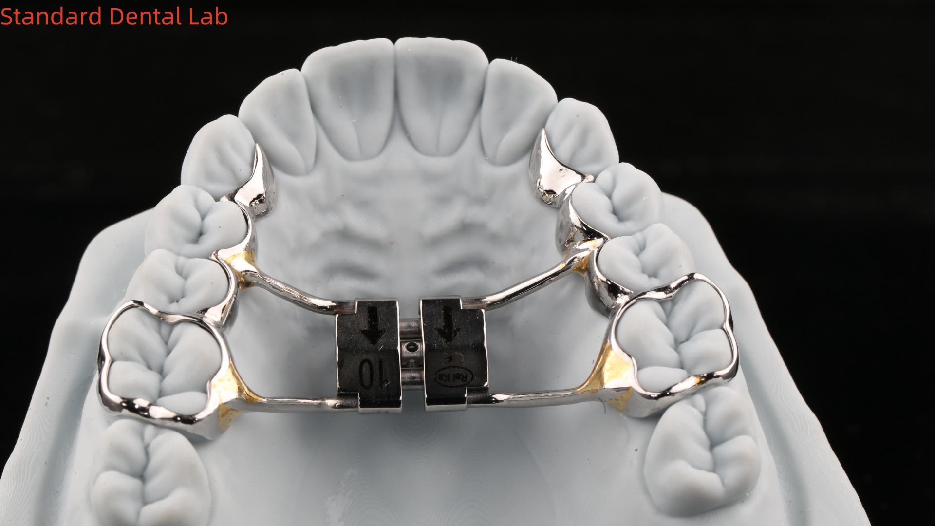 Arch Teeth Palate Expander Stable Hyrax Palatal Expander Perfect Fit SDL Dental Lab Orthodontics Appliance