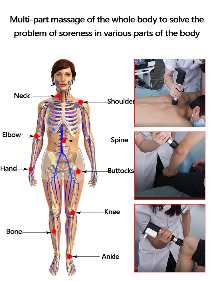 Body Pain Extracorporeal Shockwave Therapy Machine For ED Erectile Dysfunction