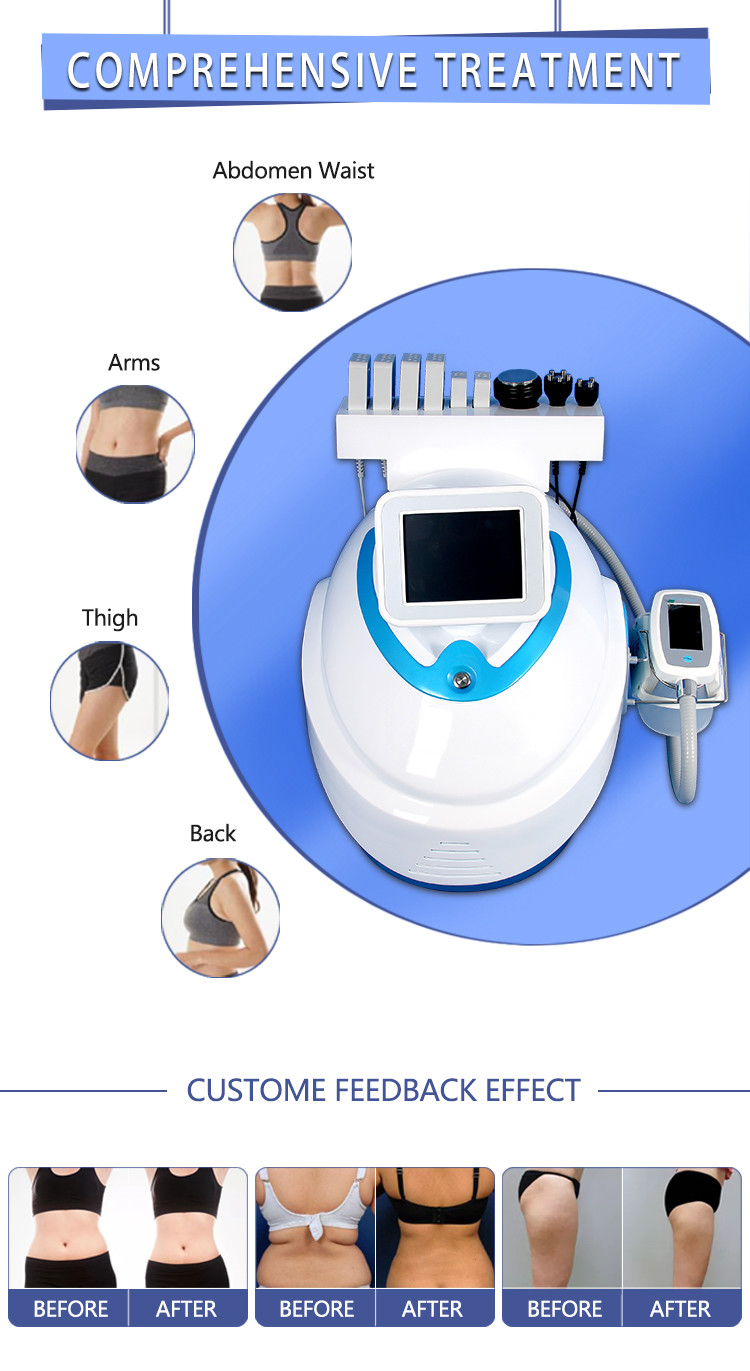 4 in 1 weight loss cavitation rf cryolipolysis lipo laser/criolipolisis fat freezing machine/cryolipolysis slimming mach