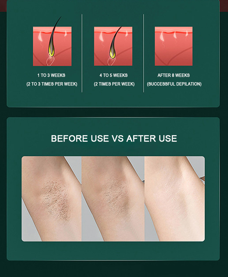 Professional 48W 999999 Flashes Home Laser Hair Removal Device