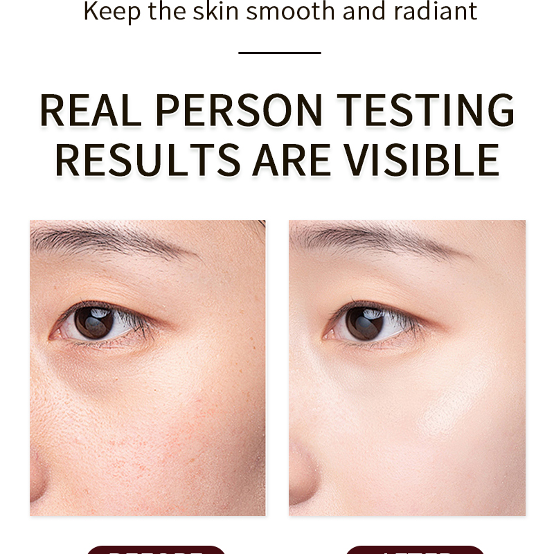 Skin Care Deep Clean Body Lotion Essens Hydrating Nourish Whitening Hyperpigmentation Treatment Skin Care