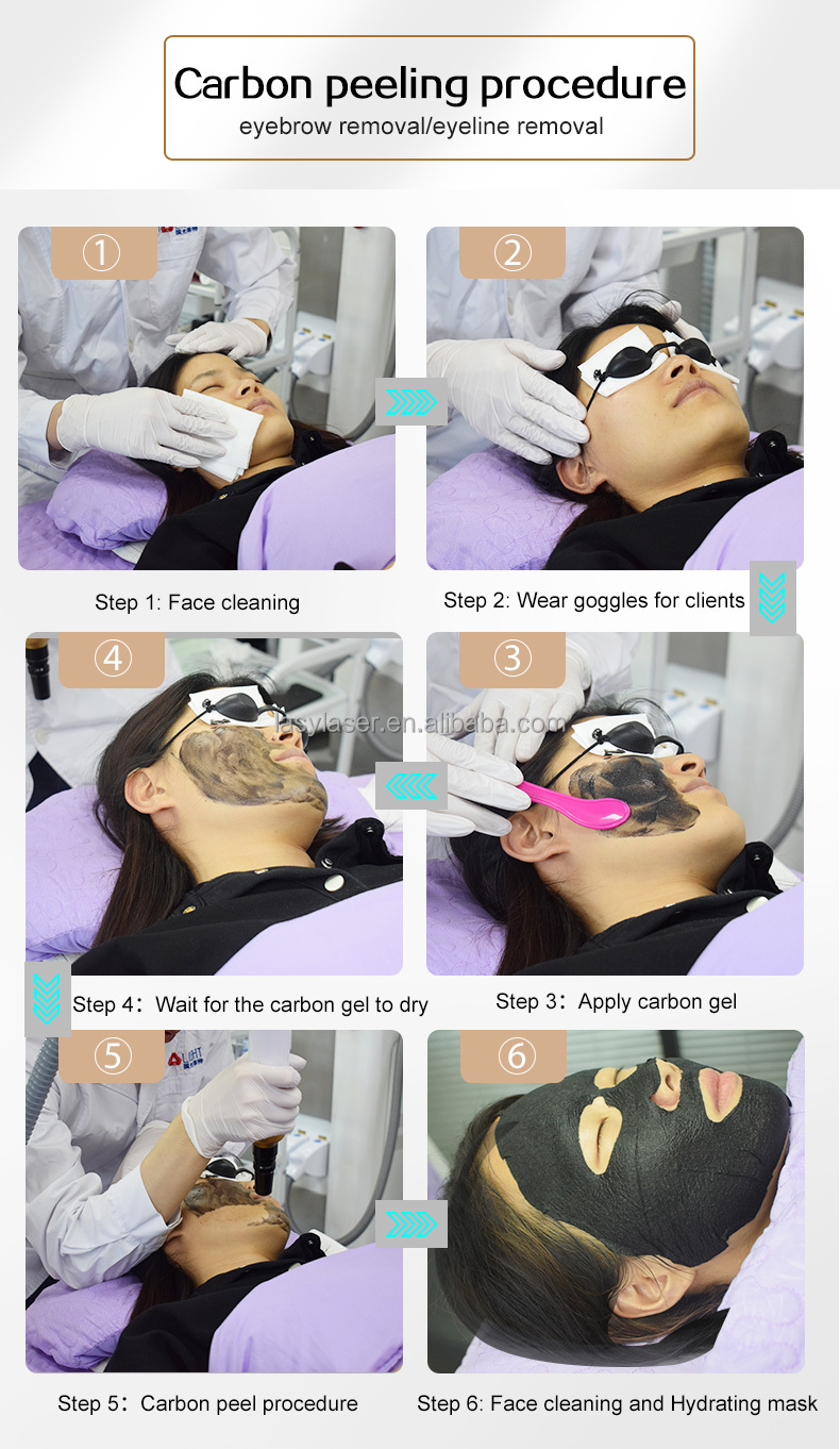 Microblading 532nm picolaser Laser Machine 1064nm Permanent Makeup