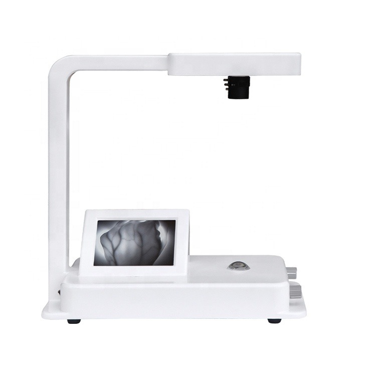 China Best Price Portable Vein Finder Clear Version