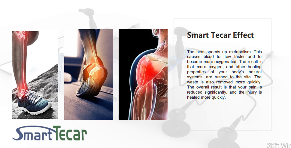 3 In1 EMS Smart Tecar Ret Cet Shockwave Therapy Machine For Pain Relief