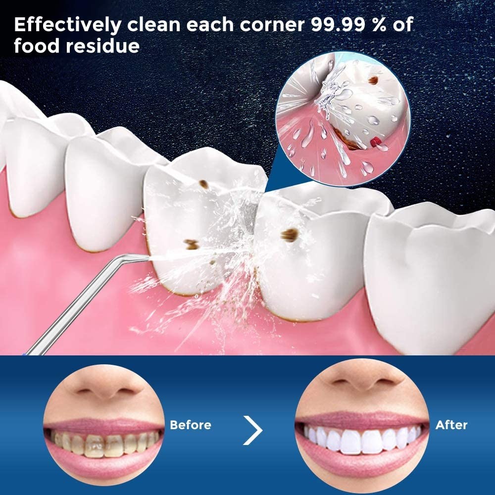 CE UKCA Approved Cordless Water Flosser With 5 Work Modes Water Pick