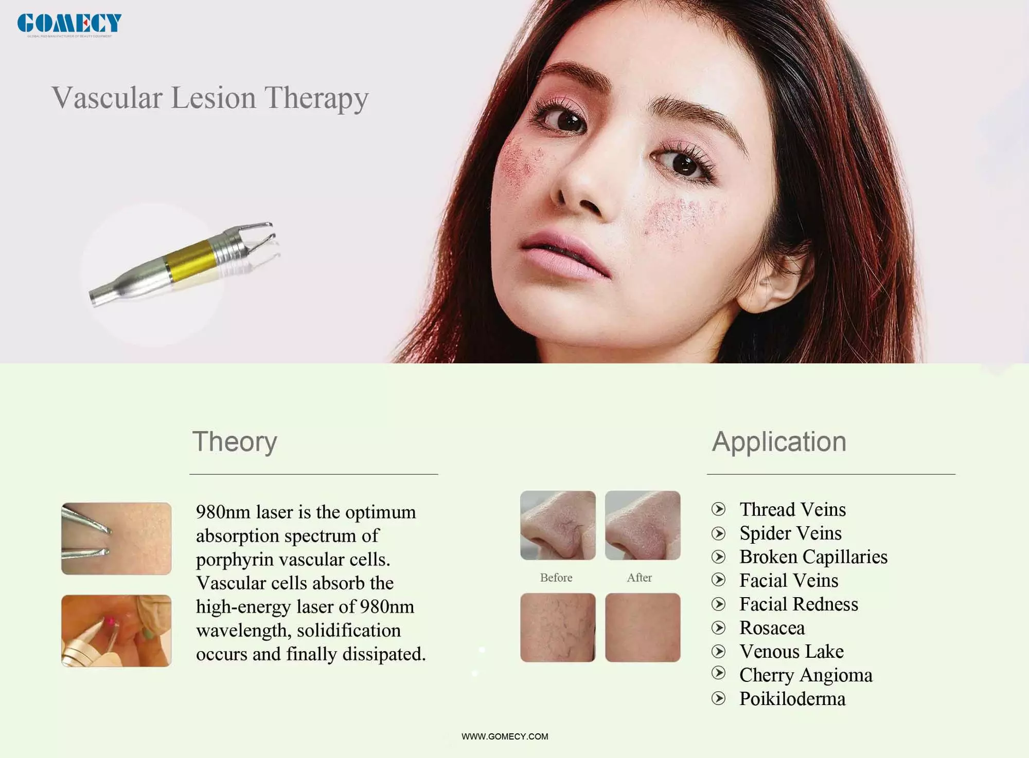 980nm 1470nm Diode Laser Lipolysis Machine For Beauty Center