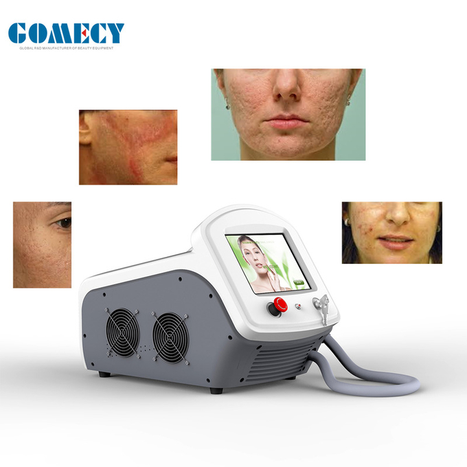Rectangle Spot Pattern Er Yag Laser Machine Air Cooling Randomized Scanning