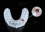 Universal Angled Screw Channel Compatible With Cad / Cam Systems