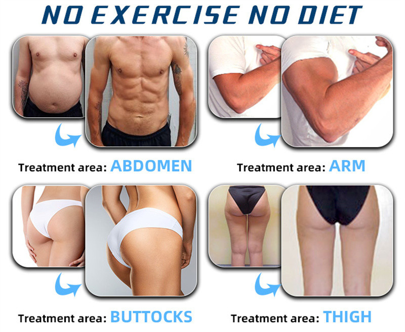 Zohonice Sculpting Electo Magenetic Body Slimmingting Machine Pelvic Floor Recovery Slimming Body Sculpting