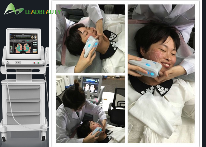 Distributors wanted hifu wrinkle removal/hifu face lift/portable hifu machine with 15 inch big screen