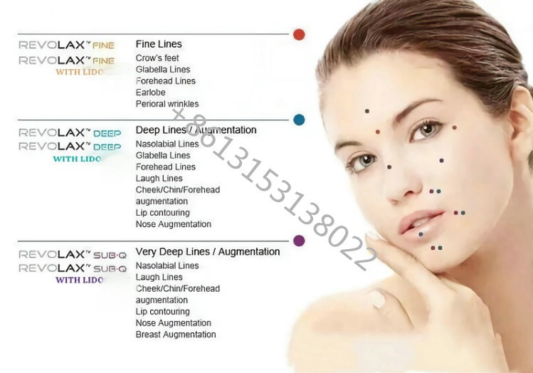 Korea Revolax Fine Injectable Ha Dermal Filler Hyaluronic Acid Injection 1.1ml