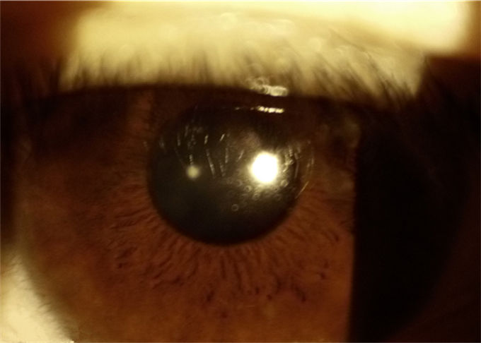 Telemedicine Application Ophthalmology Device Portable Slit Lamp With Slit Width 0-12mm Continuously Adjustable