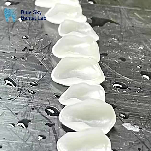 0.3mm Thin Glass Ceramic Veneer Implants Lightweight Veneer Cases