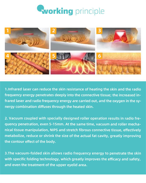 110V To 240V Cavitation RF Vacuum Slimming Machine