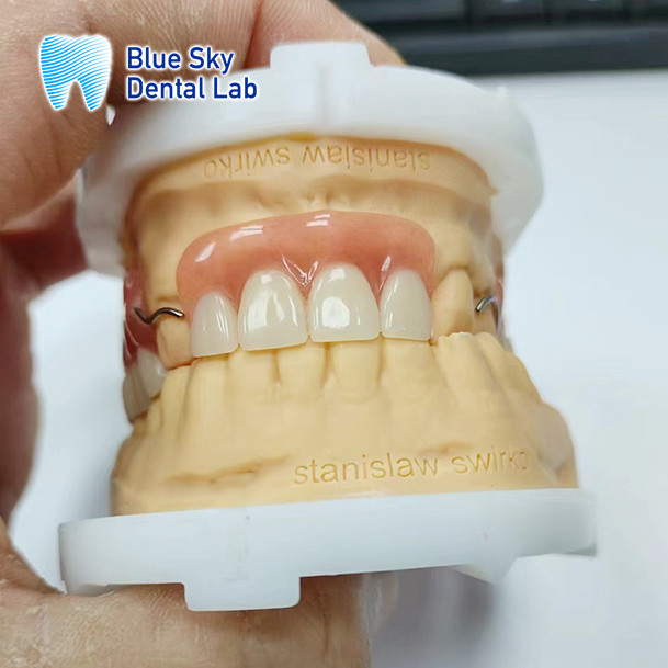 Full Arch Removable Acrylic Denture Customizable Natural Looking Denture