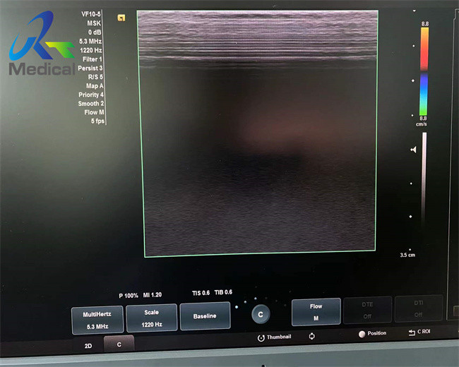 VF10 5 Compatible Ultrasound Probe Siemens Ultrasound Probe